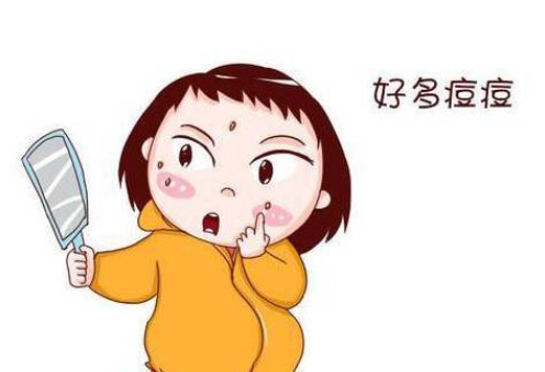 吃辣会长痘?真的不是!ta才是罪魁祸首