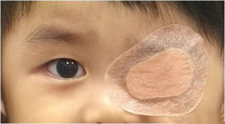 儿童斜视的新医治进展