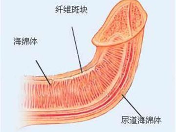男人丁丁长硬块可能得了这种疾病