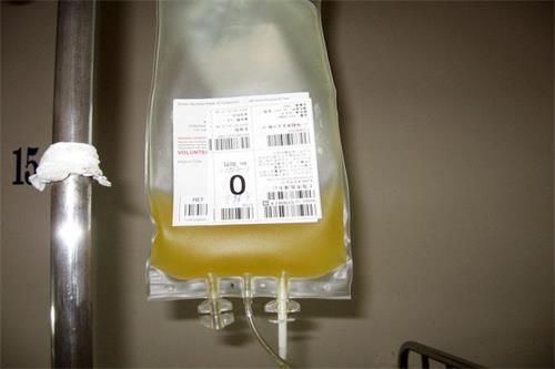 血小板降低就输血小板,是不是不太好?