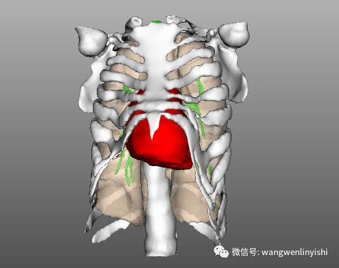 前重度畸形,典型的窒息性胸廓发育不良表现)入院查体:前胸壁重度畸形