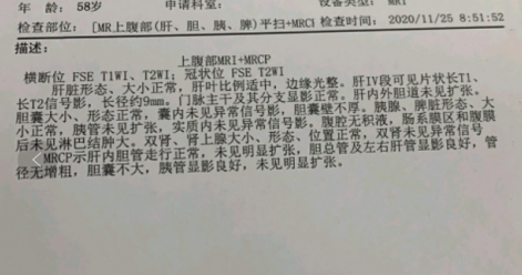 【经典问答】ct查出胰头钙化灶是胰腺癌吗?