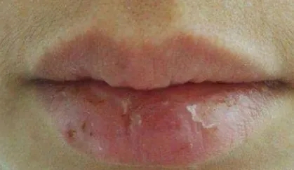 不让干燥起皮的嘴唇降低颜值,你需要这样做.