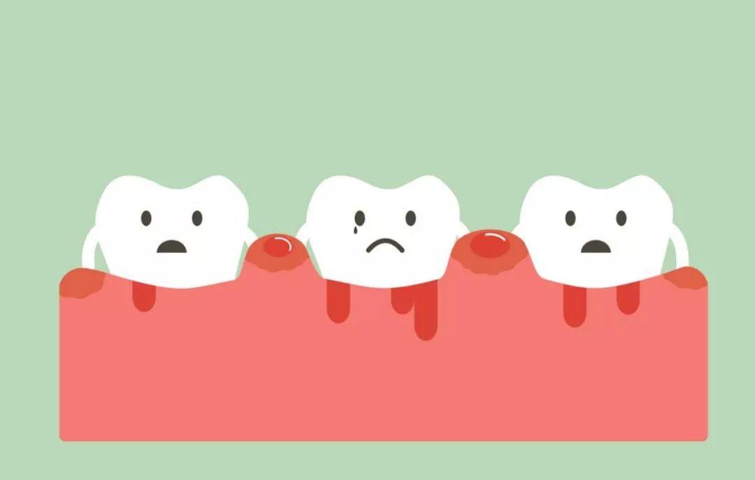 懷孕時,體內激素水平變化,免疫力降低,牙齦中血管增生,血管的通透性