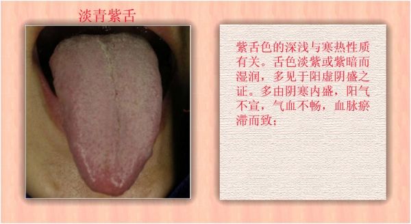 舌苔白厚是胃寒舌苔黄厚是胃热