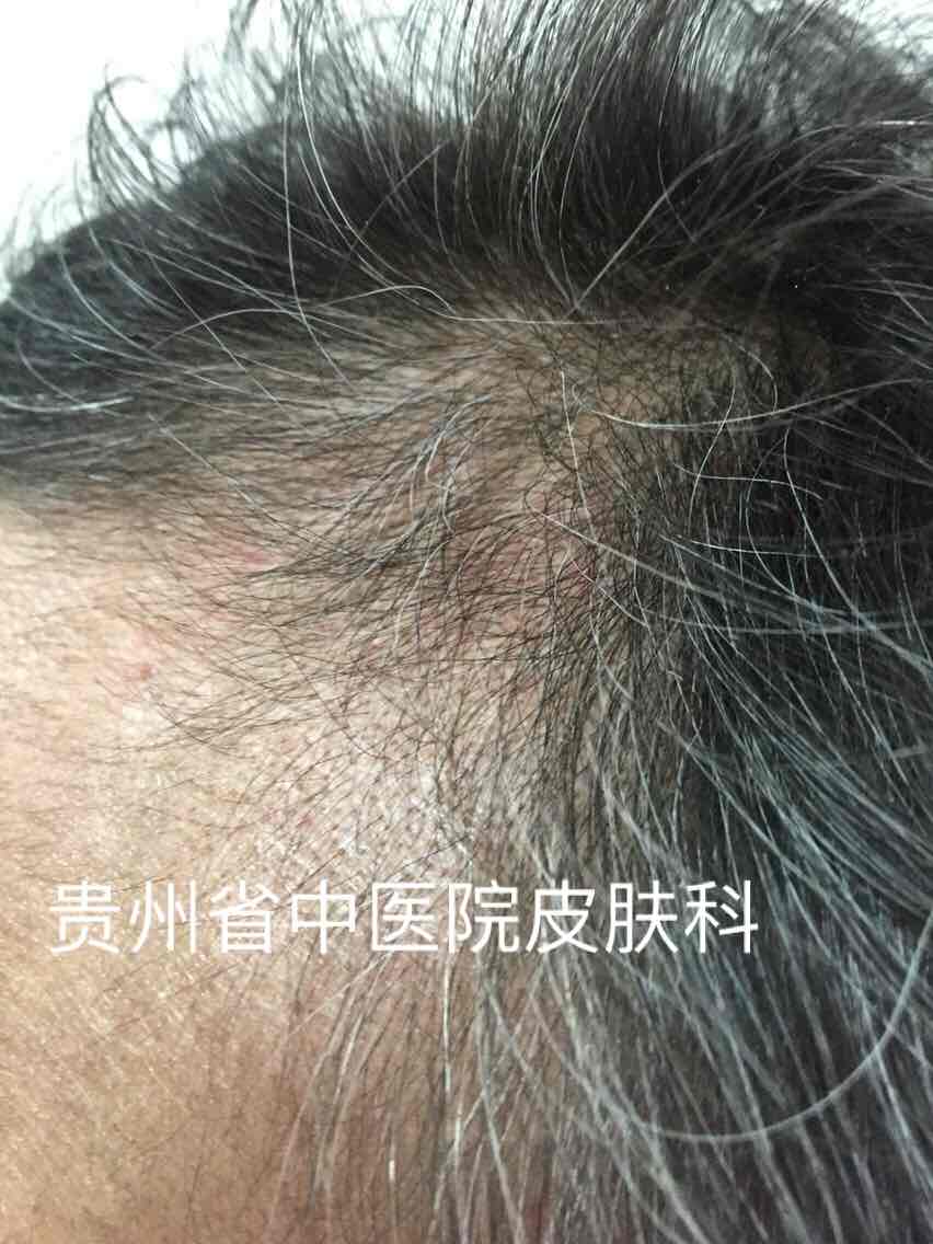 我的2017年04月22日诊间日记