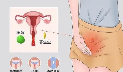 女性尿道口息肉的症状图片