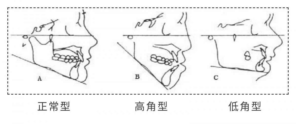不用削骨正畸就可以让你的颜值走向巅峰
