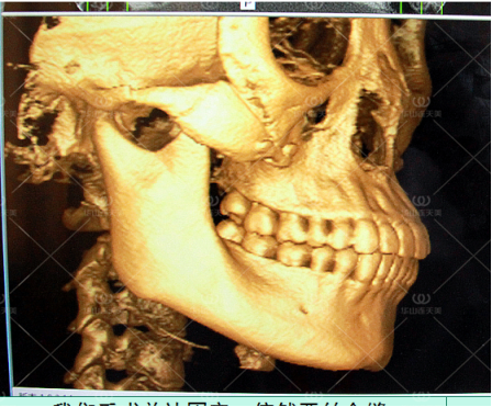 正常人颌面部ct图片图片