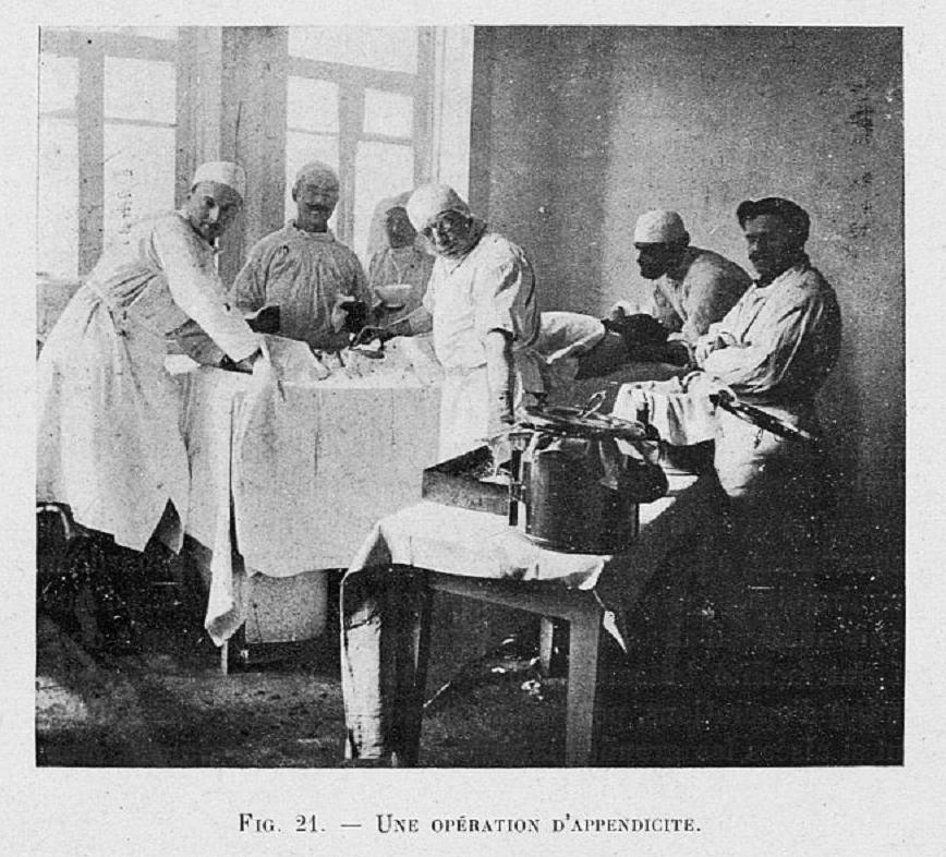 appendectomy_at_the_french_hospital_in_tiflis_(dartigues_1919).