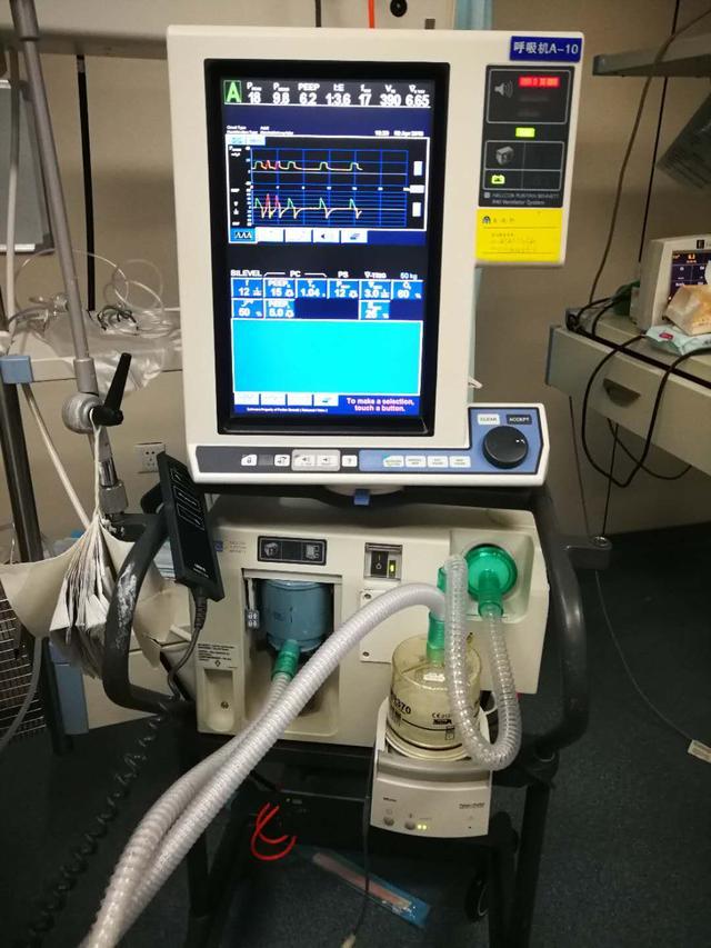 icu呼吸机多少钱多长时间收回成本重症医生说实话了