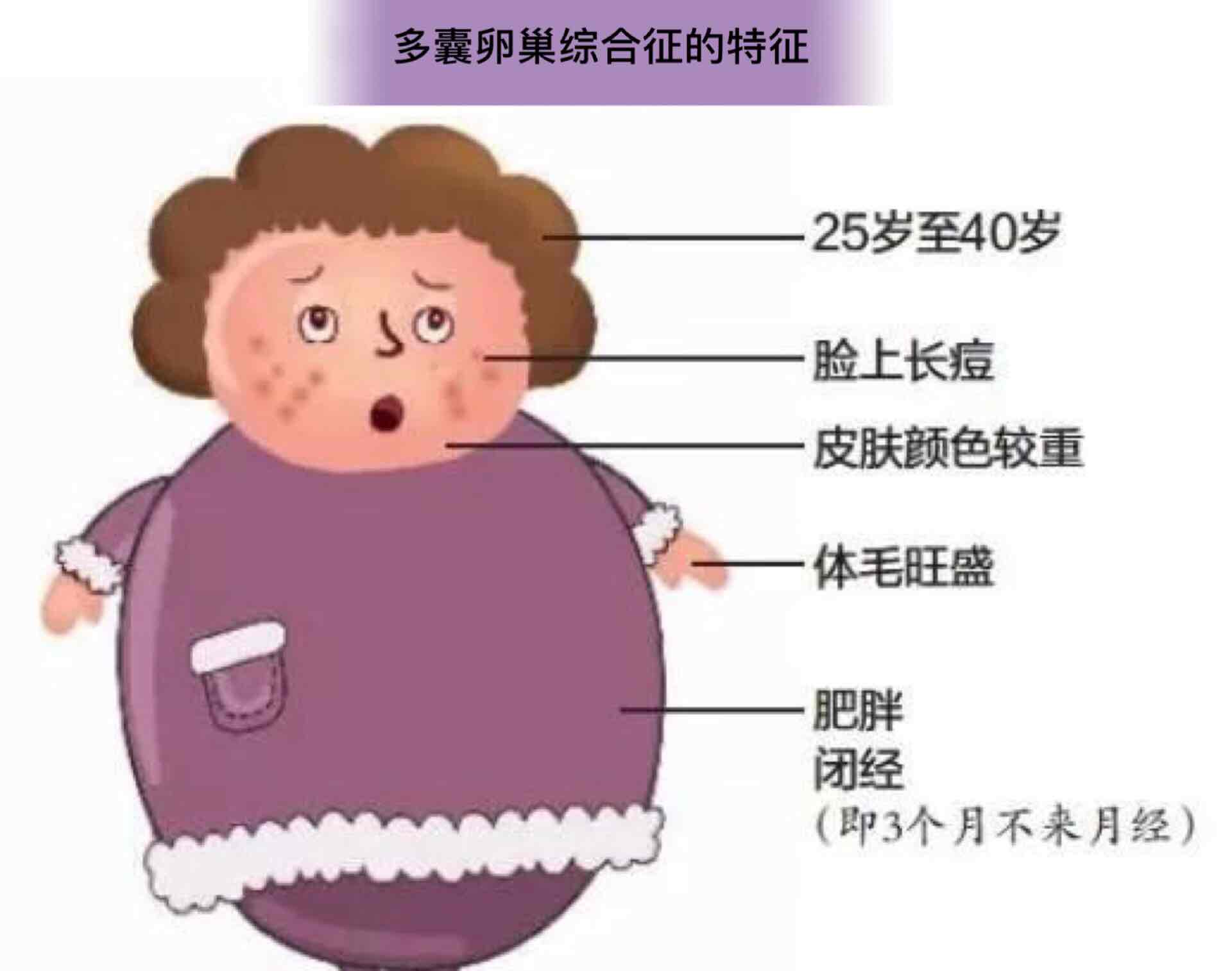 痘痘背后的真凶:多囊卵巢综合征-夏志宽-爱问医生