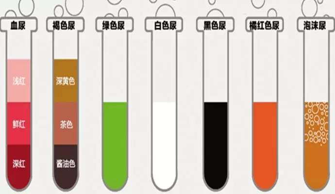 尿液的颜色可以看出我们的身体状况