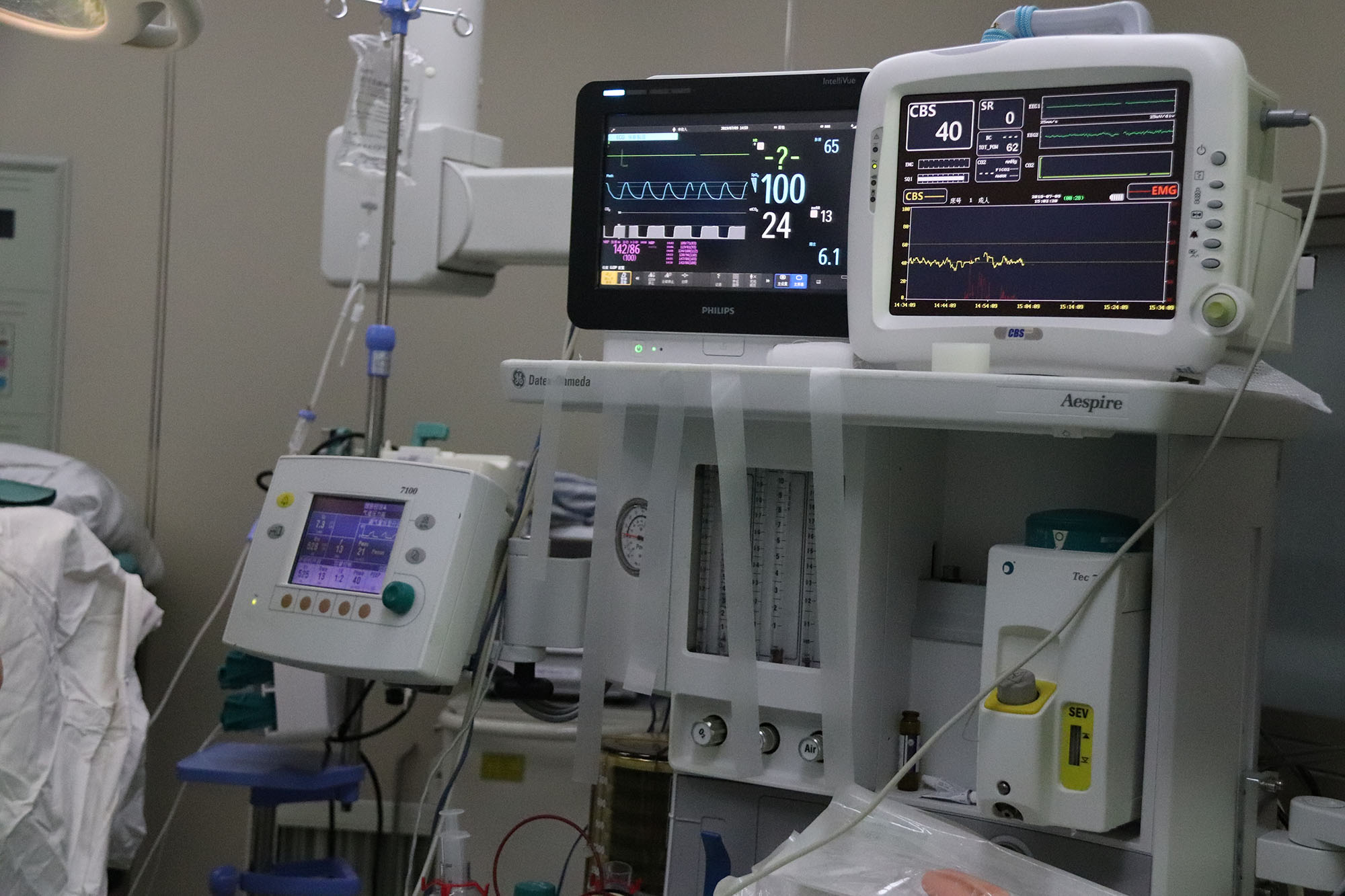 神经电生理检测在显微血管减压术中的应用