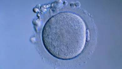 卵母细胞体外成熟技术概念