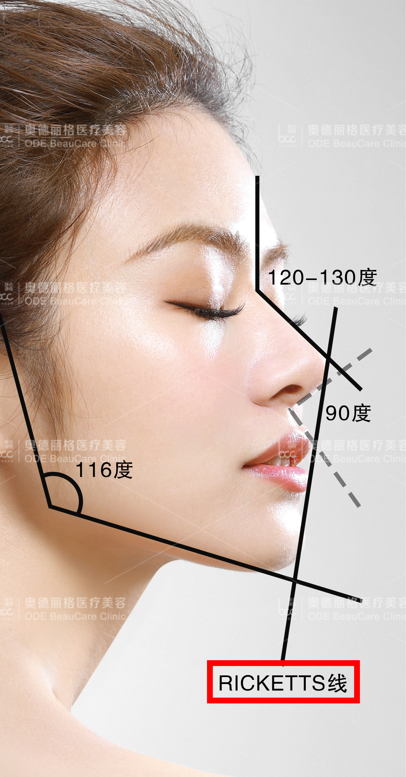 四个方面,看清颈部松弛问题!