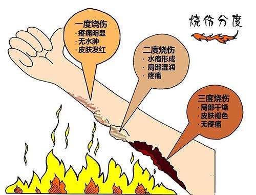 烧伤疤痕形成前后怎样护理才能避免疤痕加重