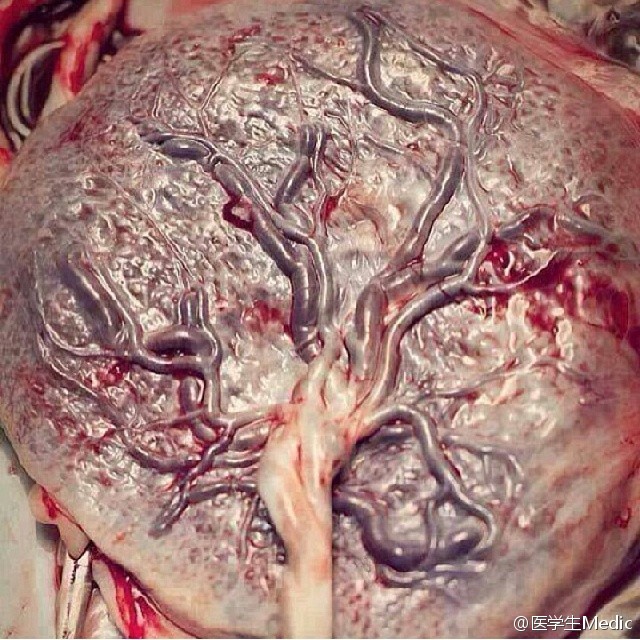 人类胎盘图片图片
