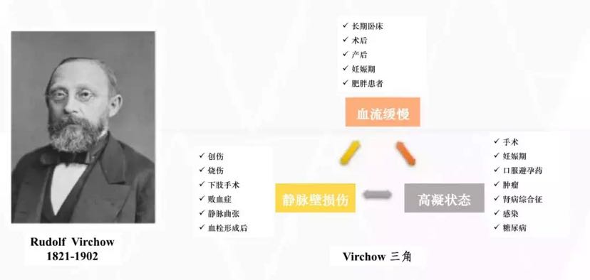 virchow三角图片