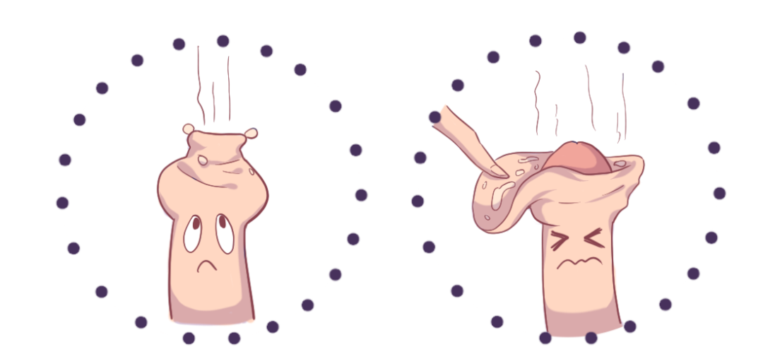 一根完美的丁丁应该长什么样子?-杨火发主任医师-爱问医生