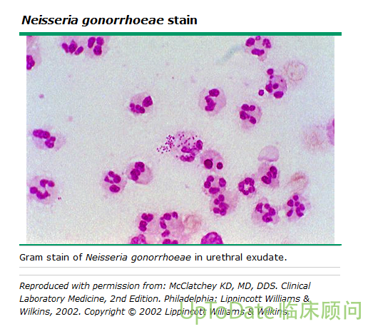 淋球菌革兰染色图片