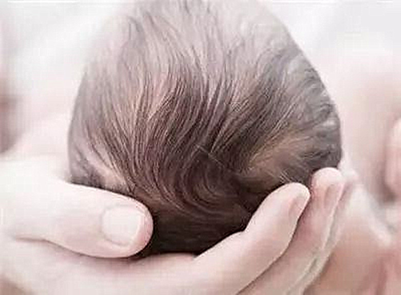 婴儿满月发型图片女图片