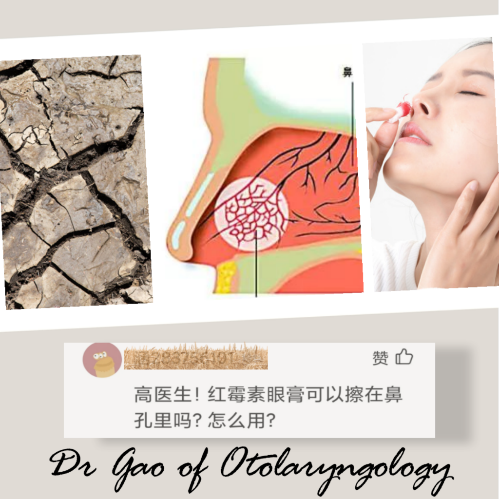 红霉素眼膏可以擦在鼻孔里吗?看了医生科普就清楚了!