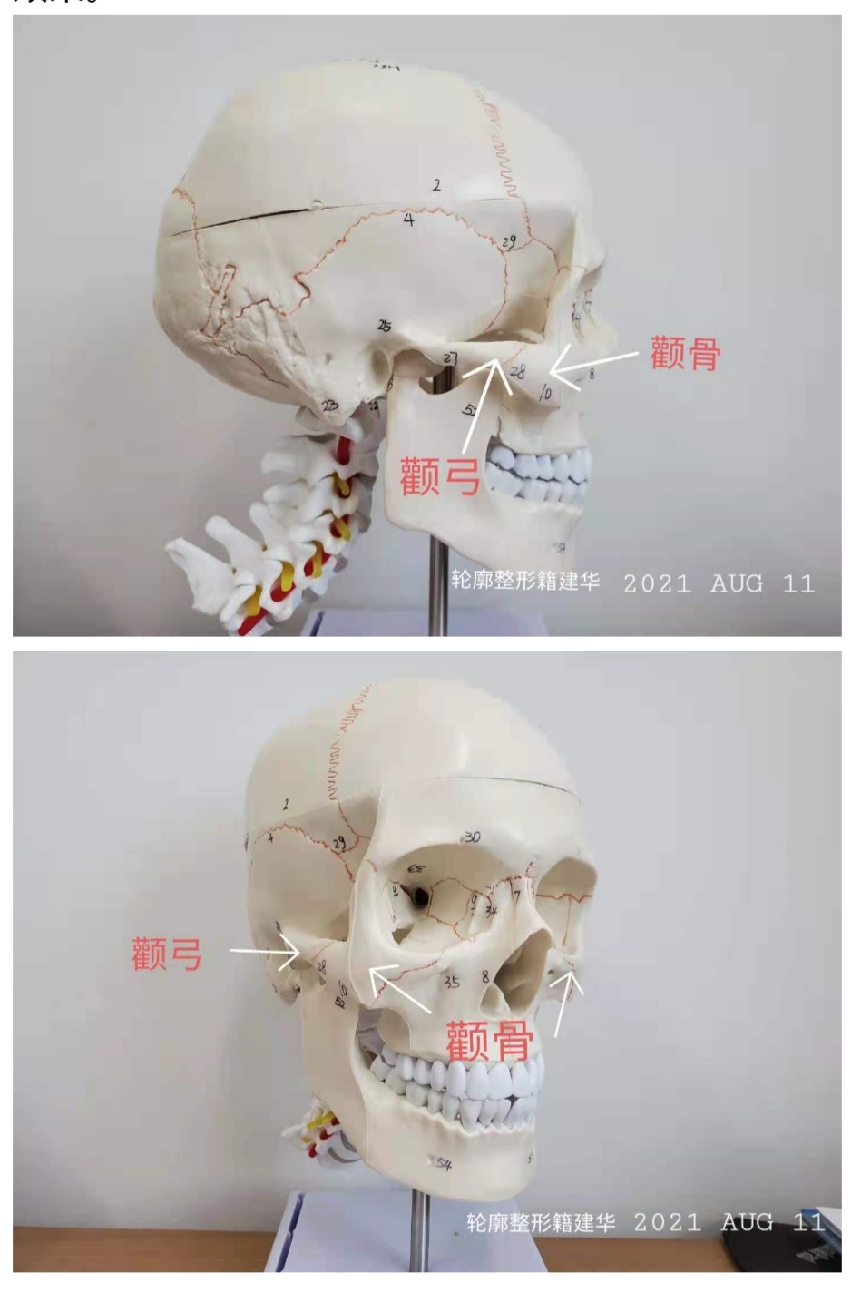 颧骨颧弓解剖图图片