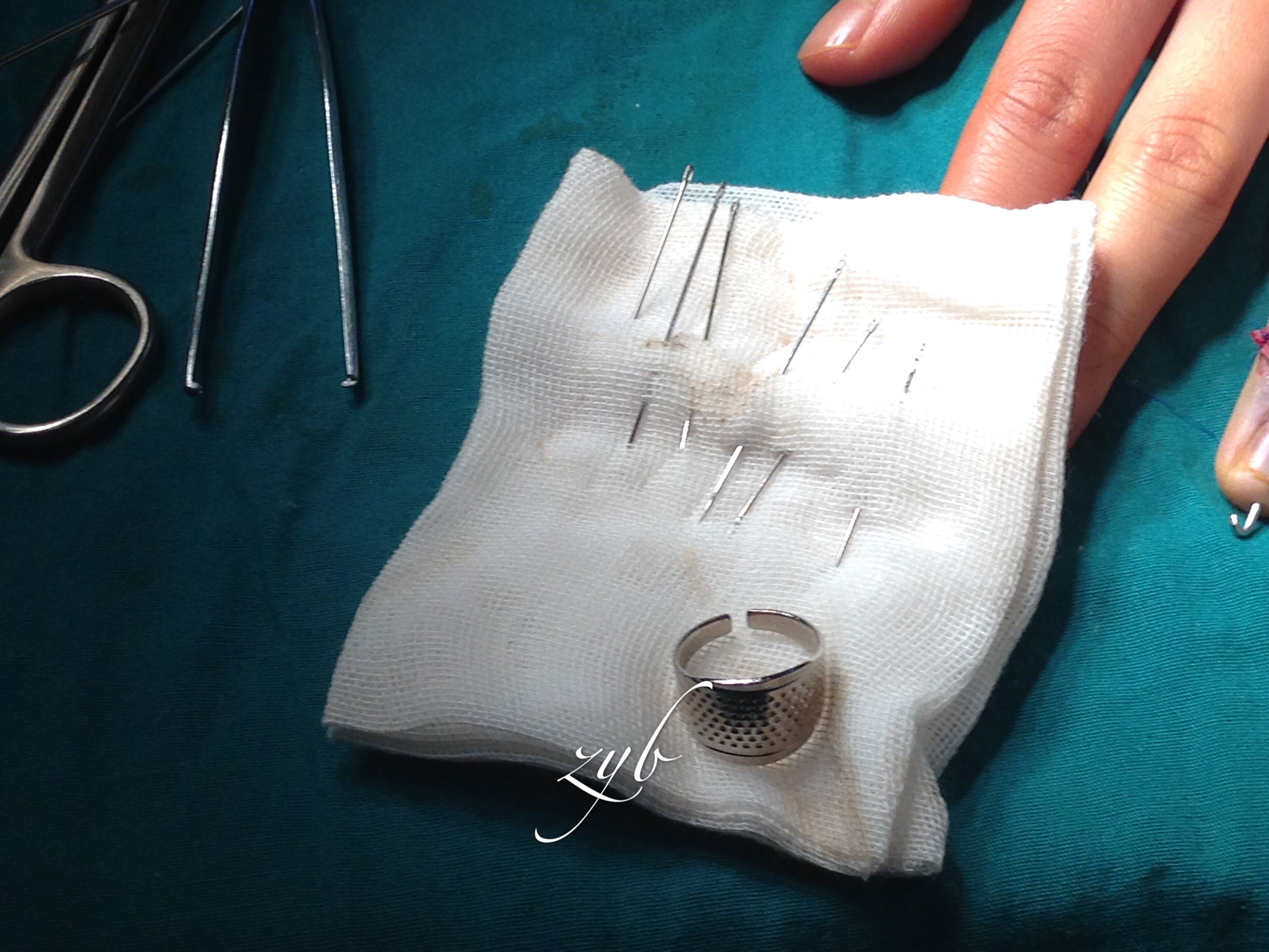 整形显微001在手指头上钉纽扣骨性锤状指的经典手术治疗