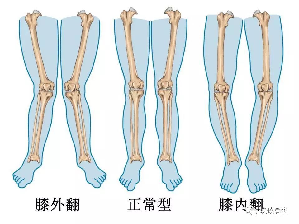 认清膝关节炎,这是我看过最好的科普文 !
