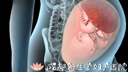 成都专业的妇产医院,新生堂妇产医院,成都顺产医院,瘢痕子宫顺产医院