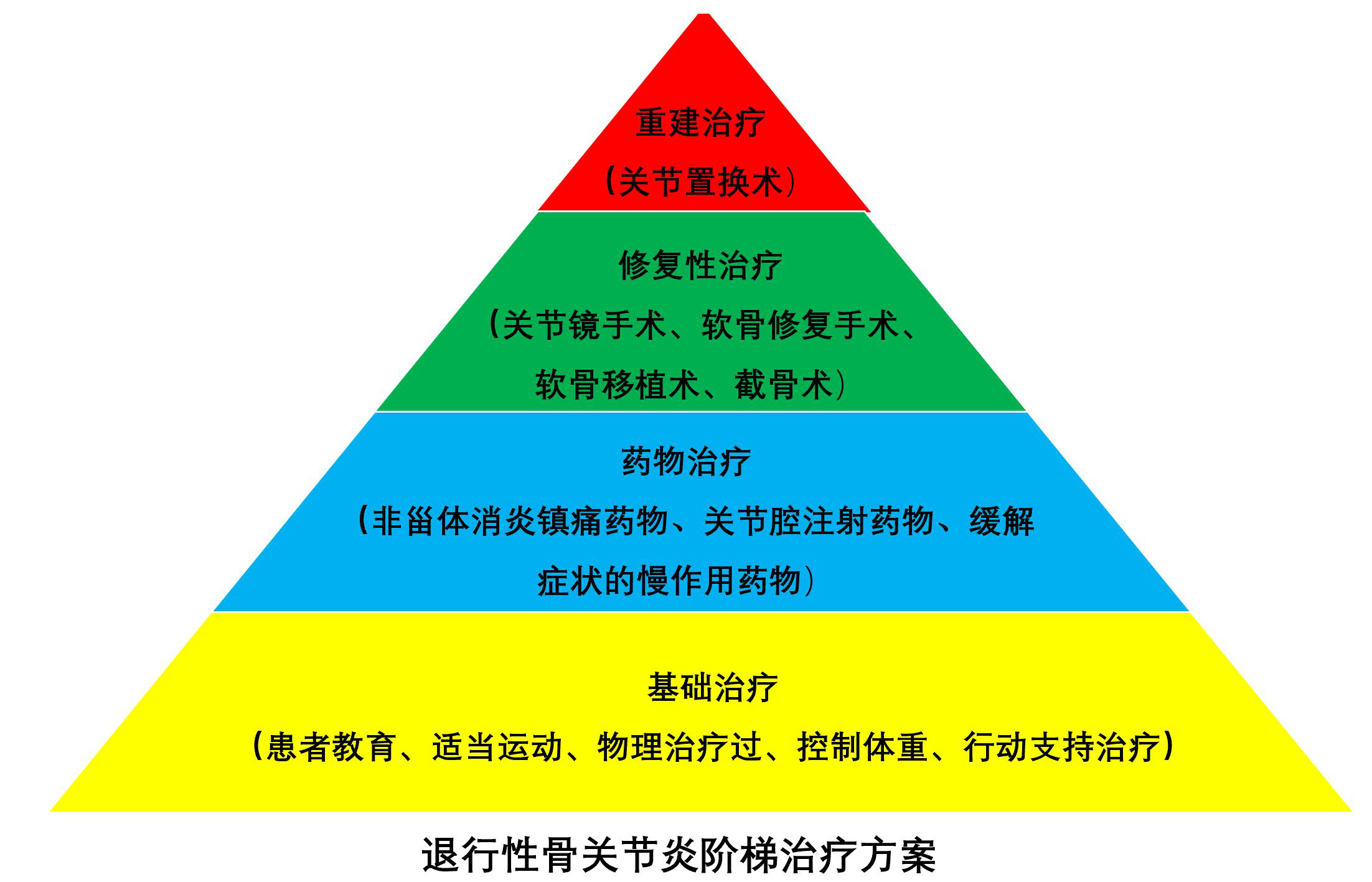 五種常見的關節炎之——退行性骨關節炎