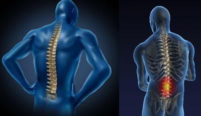 强直性脊柱炎是一种慢性炎症性疾病,以脊柱为主要病变部位,主要侵犯