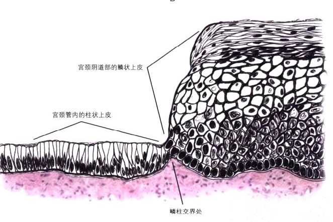 宫颈柱状细胞图片