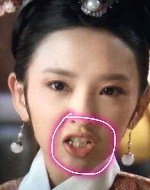 唐艺昕整容又被扒出, 这次有整容前照片, 有理有据