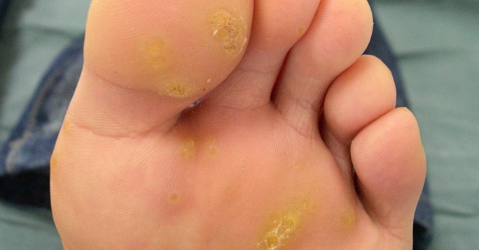 刺瘊瘊子休子是什么鬼