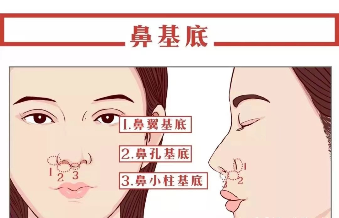 鼻子塌,鼻基底凹陷怎么办?