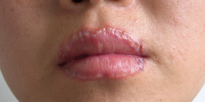 嘴唇究竟做错了什么?