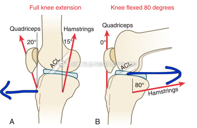 Acl重建术后咋练劲儿才不会拉松韧带 你做到了吗 邢剑主治医师 爱问医生