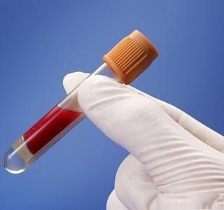 医生告诉您不吃药也能把血脂降到正常快来看看是什么办法