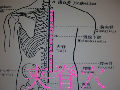 第四步:随着刮拭,夹脊穴区皮肤逐渐泛红,充血,出痧,根据之前对夹脊穴