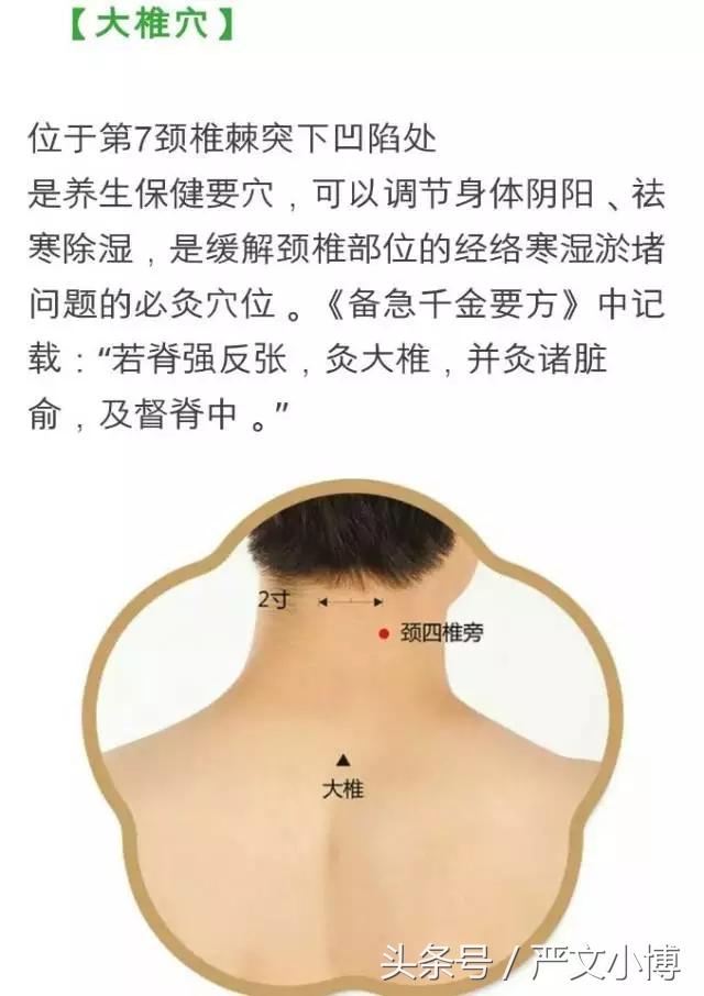 你的脖子需要拯救么