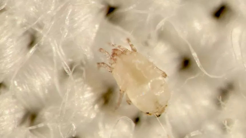 脱发,长痘…是因为每天与百万只尘螨共眠!真的吗?