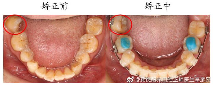 七号牙历险记