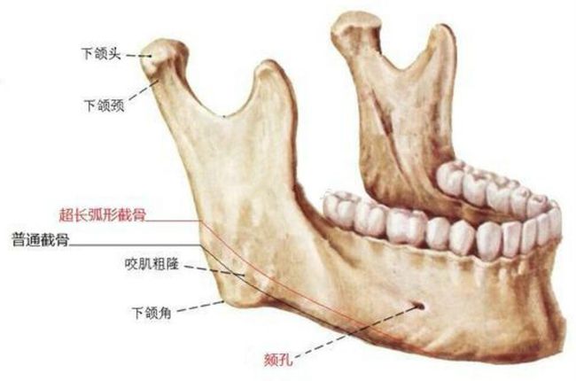 牙龈和龈颊沟示意图图片
