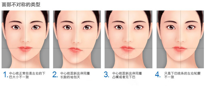 无需整形还你标准面型