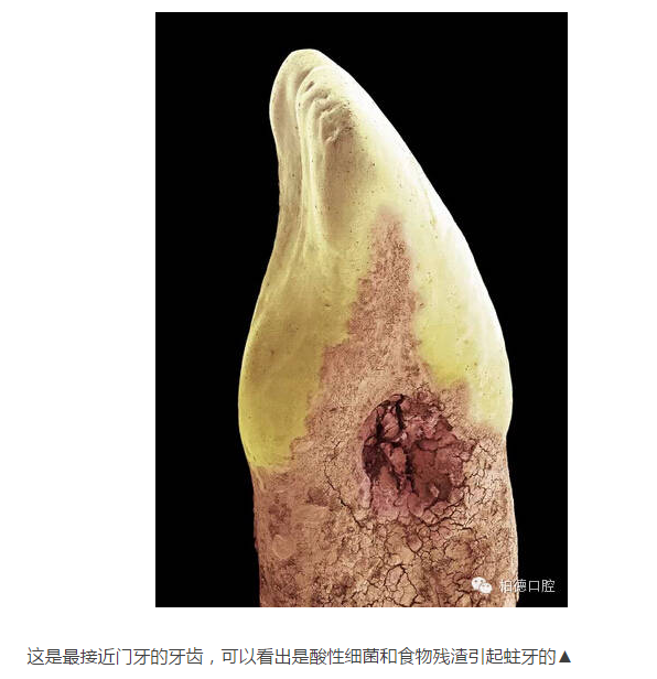 惊呆了看看显微镜下牙齿放大1000倍的样子看你以后还敢不敢不刷牙