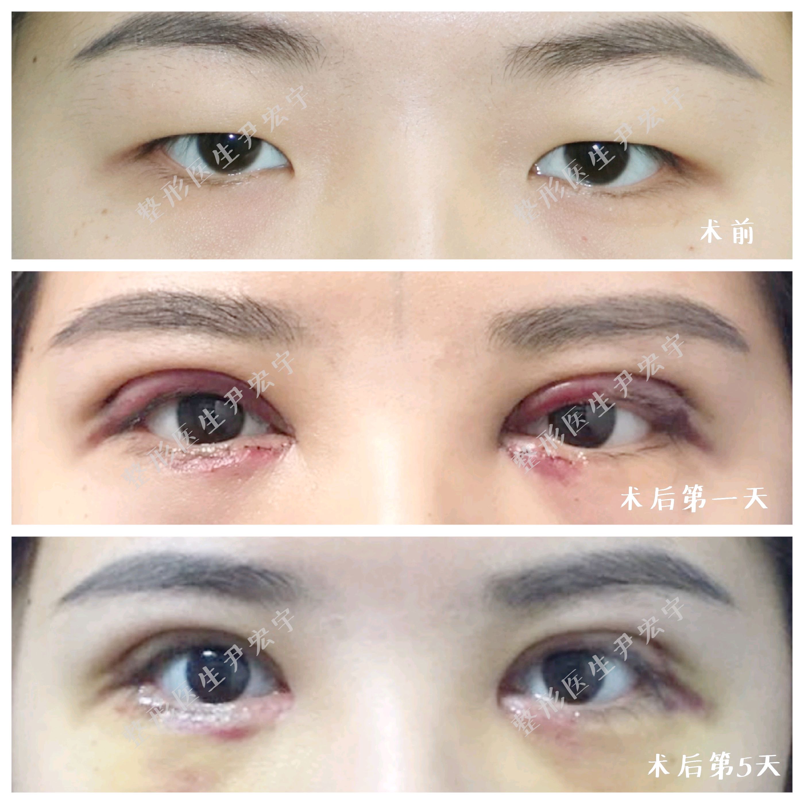 案例分析工作日志