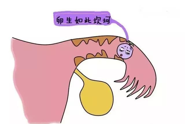 输卵管粘连会"粘"阻好孕?这么做可以找回好孕气_北京卫人医院