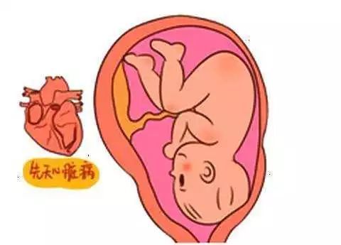 先天性心脏病的家庭养护